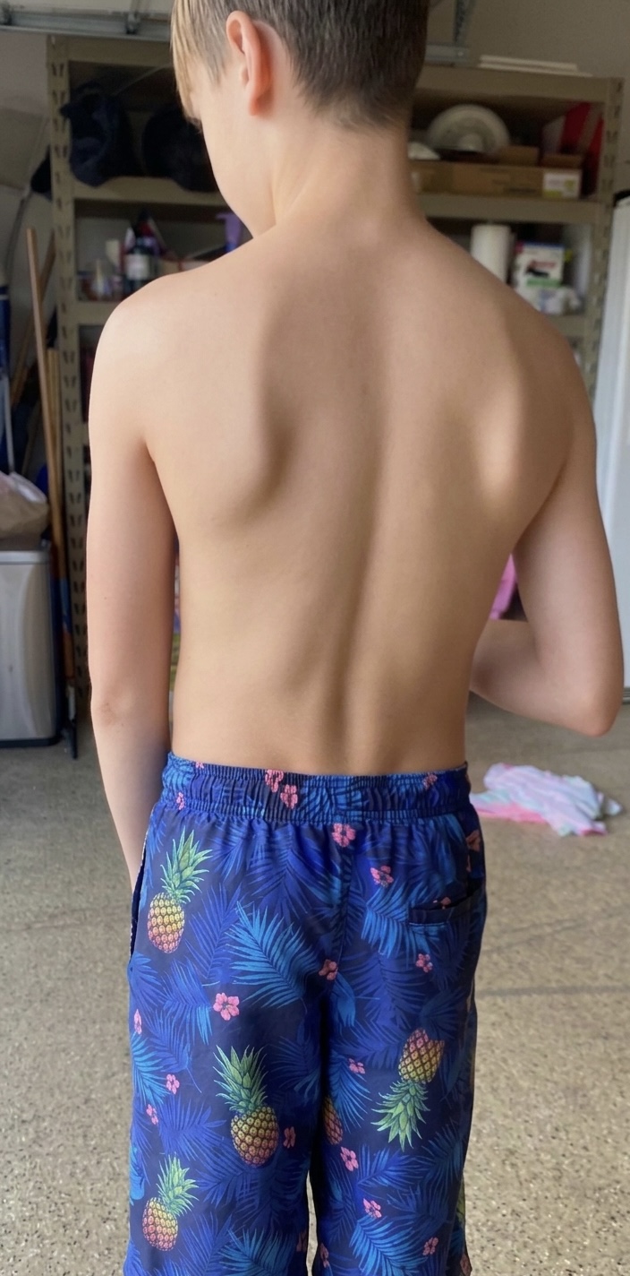 Before transformation